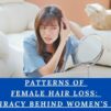 Patterns of Female Hair Loss: The Conspiracy Behind Women’s Baldness!