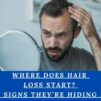 Where Does Hair Loss Start? The Early Signs They're Hiding From You!